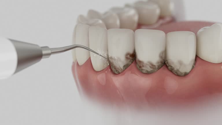 Reliable Tooth Extraction contractor in Robbins, NC by Smile Center Dentistry